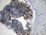 FBXO6 Antibody in Immunohistochemistry (Paraffin) (IHC (P))