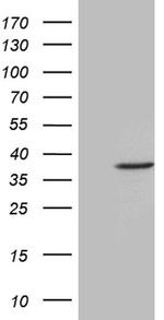 FBXO6 Antibody in Western Blot (WB)