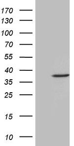 FBXO6 Antibody in Western Blot (WB)