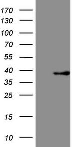 FBXO8 Antibody in Western Blot (WB)