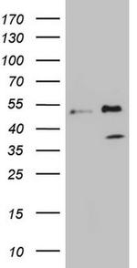FBXO8 Antibody in Western Blot (WB)