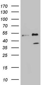 FBXO8 Antibody in Western Blot (WB)