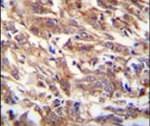 FBXW12 Antibody in Immunohistochemistry (IHC)