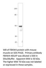 FBXW4/SHFM3 Polyclonal Antibody
