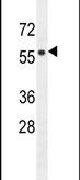 FBXW8 Antibody in Western Blot (WB)