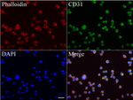 FCER2 Antibody in Immunocytochemistry (ICC/IF)