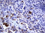 FCER2 Antibody in Immunohistochemistry (Paraffin) (IHC (P))