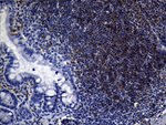 FCER2 Antibody in Immunohistochemistry (Paraffin) (IHC (P))