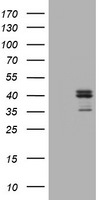 FCER2 Antibody in Western Blot (WB)