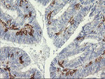 FCGR1A Antibody in Immunohistochemistry (Paraffin) (IHC (P))