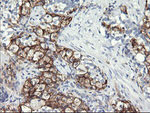 FCGR1A Antibody in Immunohistochemistry (Paraffin) (IHC (P))