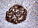 FCGR1A Antibody in Immunohistochemistry (Paraffin) (IHC (P))
