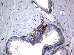 FCGR1A Antibody in Immunohistochemistry (Paraffin) (IHC (P))