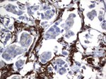 FCGR1A Antibody in Immunohistochemistry (Paraffin) (IHC (P))