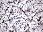 FCGR1A Antibody in Immunohistochemistry (Paraffin) (IHC (P))