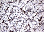 FCGR1A Antibody in Immunohistochemistry (Paraffin) (IHC (P))
