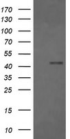 FCGR1A Antibody in Western Blot (WB)