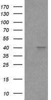 FCGR1A Antibody in Western Blot (WB)