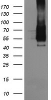 FCGR1A Antibody in Western Blot (WB)