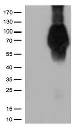 FCGR1A Antibody in Western Blot (WB)
