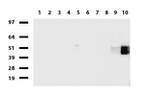 FCGR1A Antibody in Western Blot (WB)