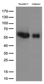 FCGR1A Antibody in Western Blot (WB)