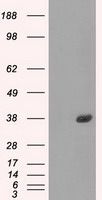 FCGR2A Antibody in Western Blot (WB)