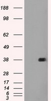 FCGR2A Antibody in Western Blot (WB)