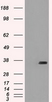 FCGR2A Antibody in Western Blot (WB)