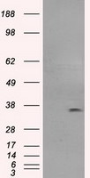 FCGR2A Antibody in Western Blot (WB)