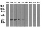 FCGR2A Antibody in Western Blot (WB)