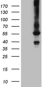 FCRLB Antibody in Western Blot (WB)