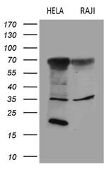 FCRLB Antibody in Western Blot (WB)