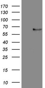 FCRLB Antibody in Western Blot (WB)