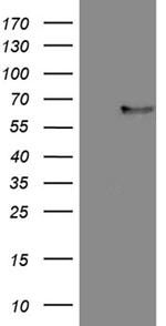 FCRLB Antibody in Western Blot (WB)