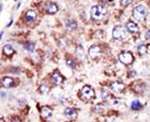 FDFT1 Antibody in Immunohistochemistry (IHC)
