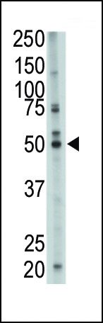 FDFT1 Antibody in Western Blot (WB)