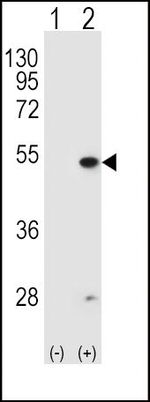 FDFT1 Antibody in Western Blot (WB)