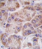 FDPS Antibody in Immunohistochemistry (IHC)