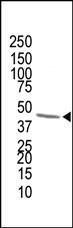 FDPS Antibody in Western Blot (WB)