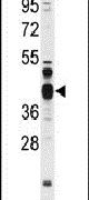 FEN1 Antibody in Western Blot (WB)