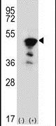 FEN1 Antibody in Western Blot (WB)