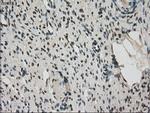 FERMT2 Antibody in Immunohistochemistry (Paraffin) (IHC (P))