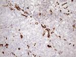FERMT3 Antibody in Immunohistochemistry (Paraffin) (IHC (P))