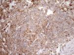 FERMT3 Antibody in Immunohistochemistry (Paraffin) (IHC (P))