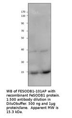 FeSODB1 Antibody in Western Blot (WB)
