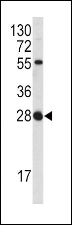 FGF18 Antibody in Western Blot (WB)