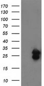 FGF21 Antibody in Western Blot (WB)