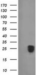 FGF21 Antibody in Western Blot (WB)