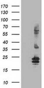 FGF21 Antibody in Western Blot (WB)